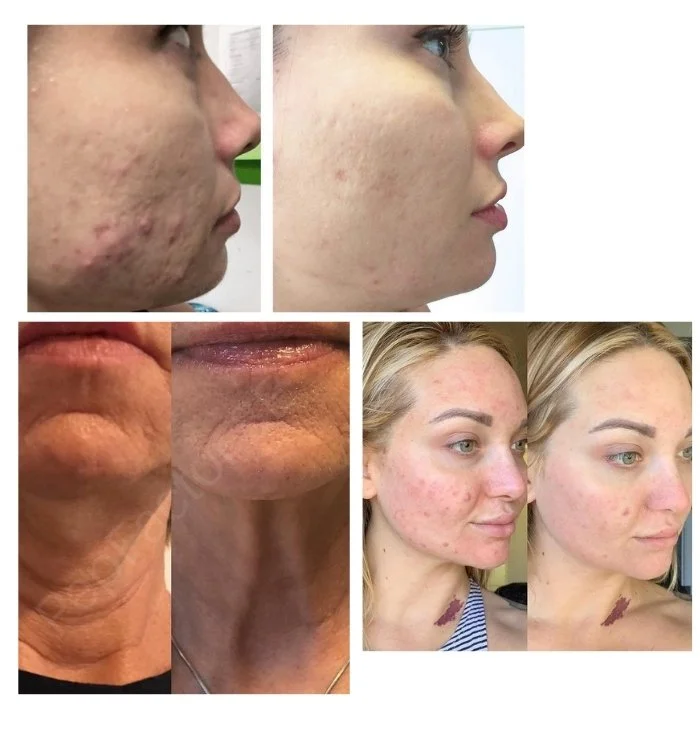 PepFactor Skin Results | ReGen Factor